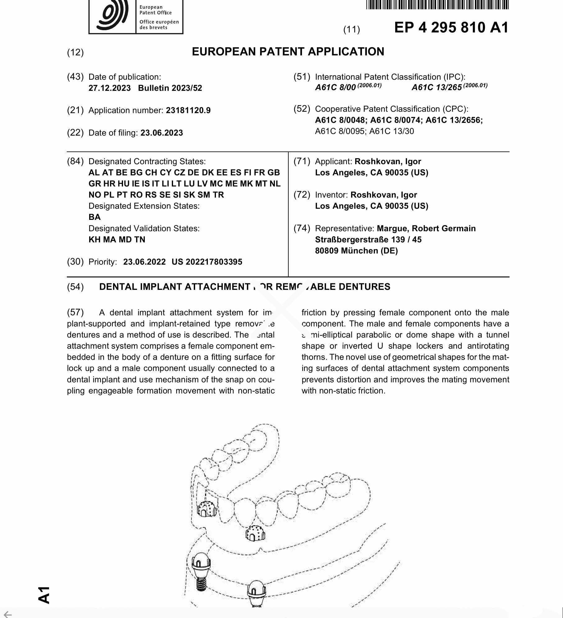 Page of European Patent Application EP 4 295 810 A1 with a drawing of a dental arch and implant attachments.