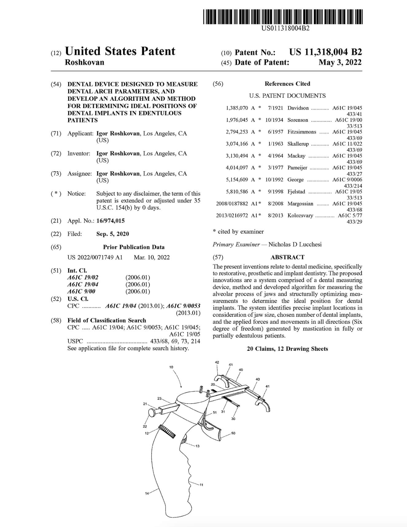 First page of United States Patent US 11,318,004 B2 with a drawing of the dental arch measuring device.